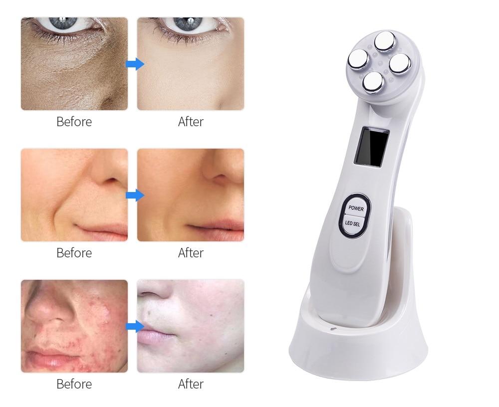 Mesotherapy Electroporation RF Radio Frequency Facial LED Photon Skin Care Device Face Lifting Tighten Wrinkle Removal Eye Care - S'roushaa